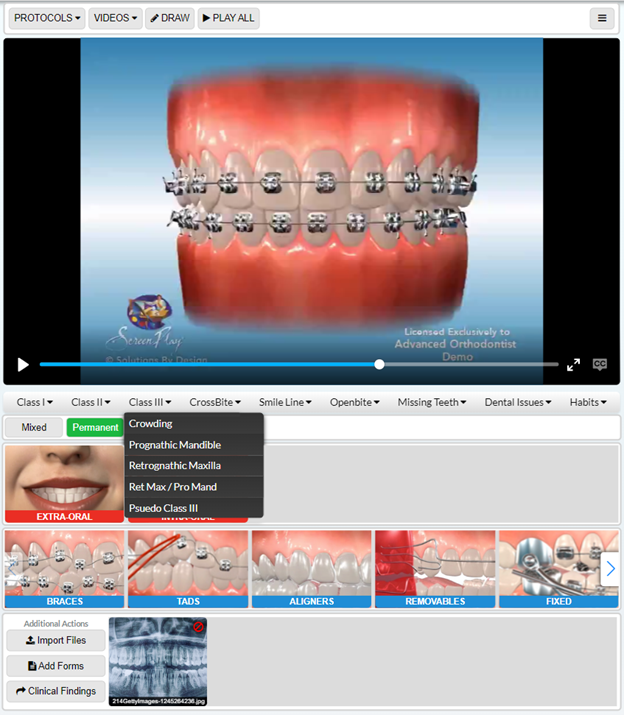 Malocclusion Specific